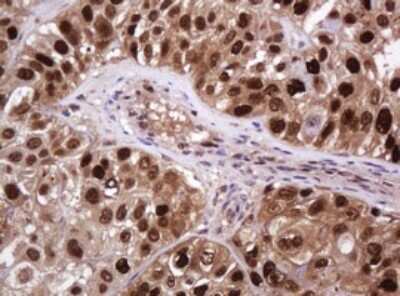 Immunohistochemistry: PCNA Antibody (OTI3D6) [NBP2-46342]