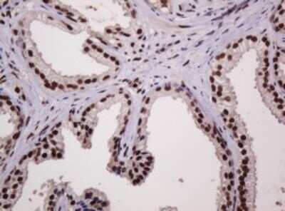 Immunohistochemistry: PCNA Antibody (OTI3D6) [NBP2-46342]