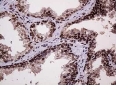 Immunohistochemistry: PCNA Antibody (OTI3D6) [NBP2-46342]
