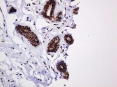 Immunohistochemistry: PCNA Antibody (OTI3D6) [NBP2-46342]