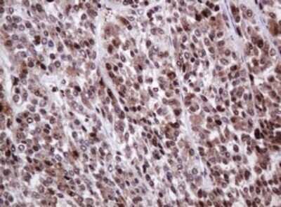 Immunohistochemistry: PCNA Antibody (OTI3D6) [NBP2-46342]