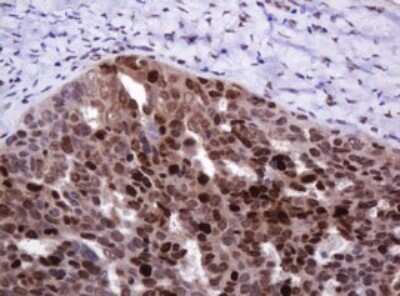 Immunohistochemistry: PCNA Antibody (OTI3D6) [NBP2-46342]