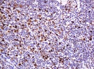 Immunohistochemistry: PCNA Antibody (OTI3D6) [NBP2-46342]