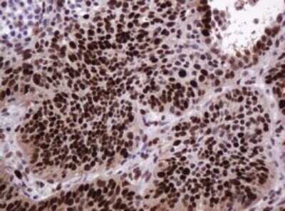 Immunohistochemistry: PCNA Antibody (OTI3D6) [NBP2-46342]
