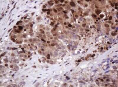 Immunohistochemistry: PCNA Antibody (OTI3D6) [NBP2-46342]