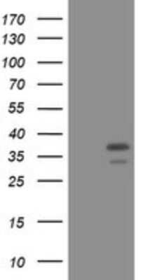 Western Blot: PCNA Antibody (OTI3D6) [NBP2-46342]