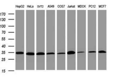 Western Blot: PCNA Antibody (OTI3D6) [NBP2-46342]