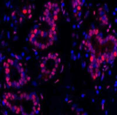 Immunohistochemistry-Paraffin: PCNA Antibody (BLR075G) [NBP2-78712]