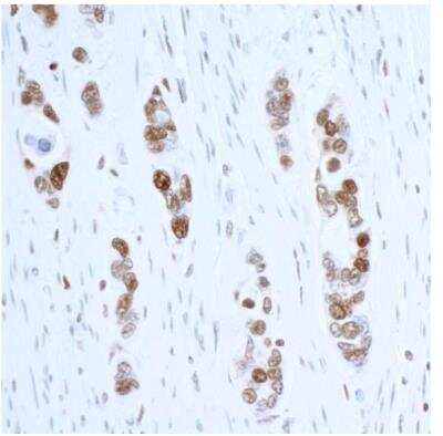 Immunohistochemistry-Paraffin: PCNA Antibody (BLR075G) [NBP2-78712]