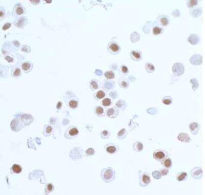 Immunohistochemistry-Paraffin: PCNA Antibody (BLR075G) [NBP2-78712]