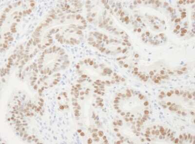 Immunohistochemistry: PCNA Antibody [NB100-456]