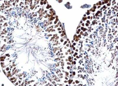 Immunohistochemistry-Paraffin: PCNA Antibody [NBP1-32075]