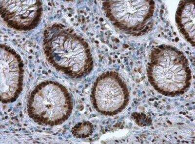 Immunohistochemistry-Paraffin: PCNA Antibody [NBP1-32075]