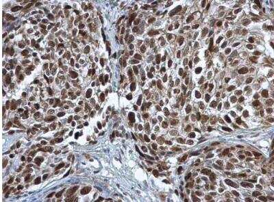 Immunohistochemistry-Paraffin: PCNA Antibody [NBP1-32075]