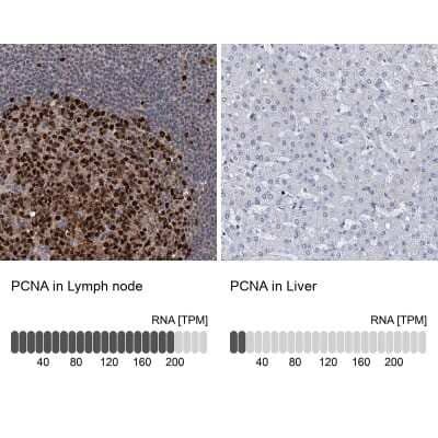 Immunohistochemistry-Paraffin: PCNA Antibody [NBP1-89503]