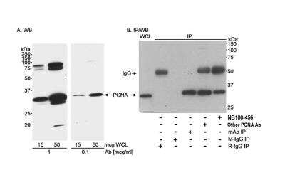 Immunoprecipitation: PCNA Antibody [NB100-456]