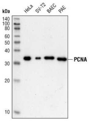Western Blot: PCNA Antibody (PC10) [NB500-106]