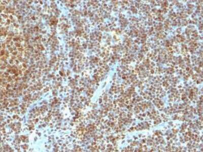 Immunohistochemistry-Paraffin: PCNA Antibody (SPM350) - Azide and BSA Free [NBP2-34767]