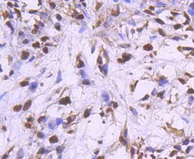 Immunohistochemistry-Paraffin: PCNA Antibody (SY12-07) [NBP2-67390]