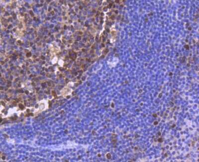 Immunohistochemistry-Paraffin: PCNA Antibody (SY12-07) [NBP2-67390]