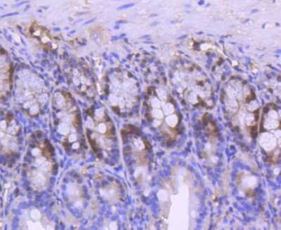 Immunohistochemistry-Paraffin: PCNA Antibody (SY12-07) [NBP2-67390]