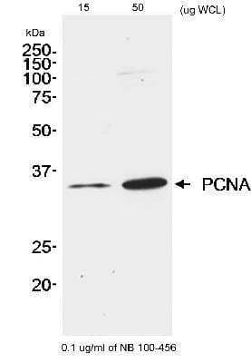 Western Blot: PCNA Antibody [NB100-456]
