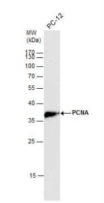 Western Blot: PCNA Antibody [NBP1-32075]