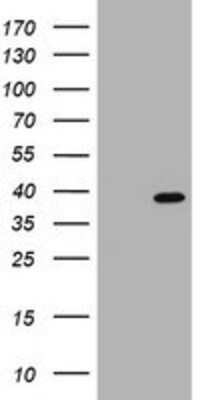 Western Blot: PCNA Overexpression Lysate [NBP2-04828]