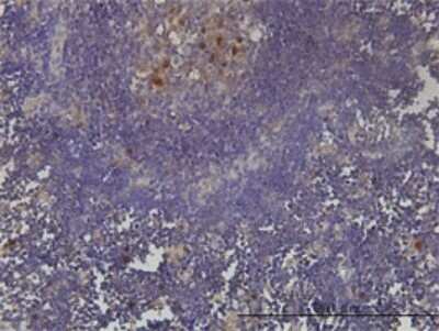 Immunohistochemistry-Paraffin: PCNA associated factor Antibody (3C11-1F11) [H00009768-M01]
