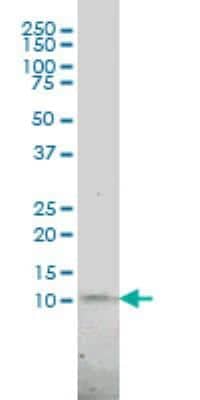 Western Blot: PCNA associated factor Antibody (3C11-1F11) [H00009768-M01]