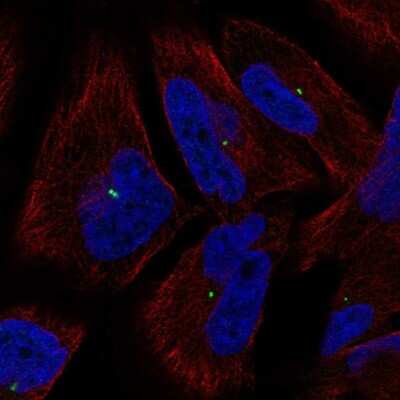 Immunocytochemistry/ Immunofluorescence: PCNA associated factor Antibody [NBP2-56949]