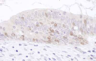 Immunohistochemistry-Paraffin: PCNA associated factor Antibody [NBP2-32117]