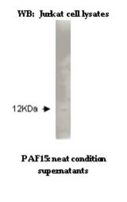 Western Blot: PCNA associated factor Antibody (K11-P1G7*B8)BSA Free [NBP2-50536]