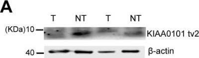 Western Blot: PCNA associated factor Antibody [NBP1-80555]