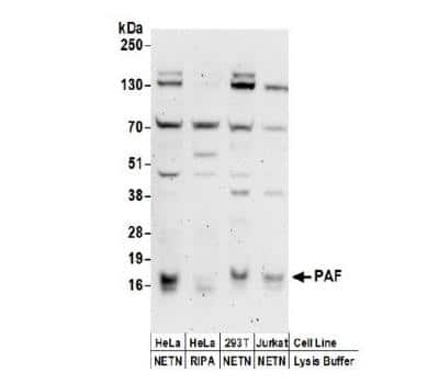 Western Blot: PCNA associated factor Antibody [NBP2-32112]