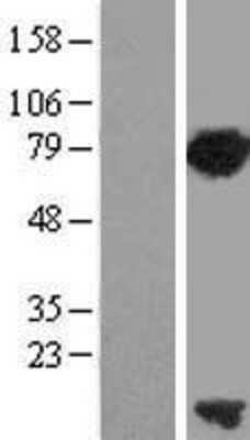 Western Blot: PCNA associated factor Overexpression Lysate [NBL1-12236]