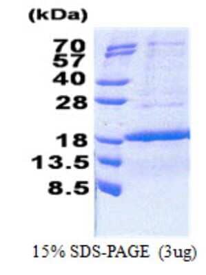 SDS-PAGE: Recombinant Human PCNA associated factor His Protein [NBP2-23168]