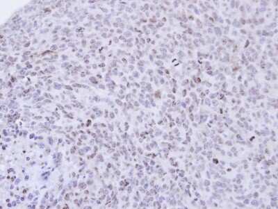 Immunohistochemistry-Paraffin: PCNP Antibody [NBP1-31692]