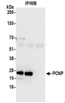 Immunoprecipitation: PCNP Antibody [NBP2-37692]