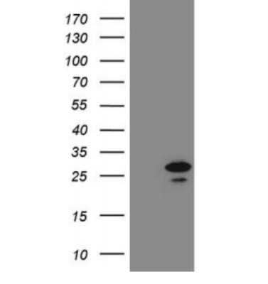 Western Blot: PCNP Antibody (OTI4E3)Azide and BSA Free [NBP2-73272]