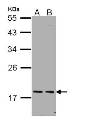 Western Blot: PCNP Antibody [NBP1-31692]