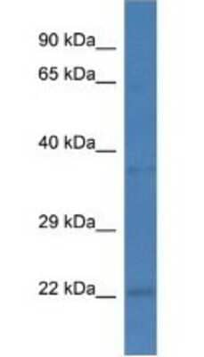 Western Blot: PCNP Antibody [NBP1-79669]