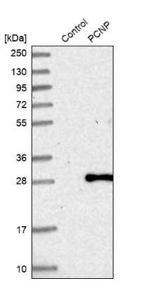 Western Blot: PCNP Antibody [NBP1-86312]