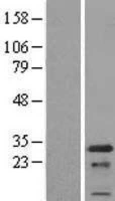 Western Blot: PCNP Overexpression Lysate [NBL1-14185]