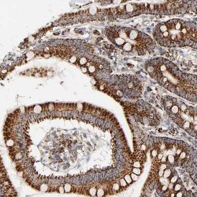 Immunohistochemistry: PCNXL4 Antibody [NBP1-87597]