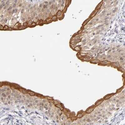 Immunohistochemistry-Paraffin: PCNXL4 Antibody [NBP1-88113]