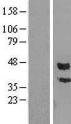 Western Blot: PCPE-1/PCOLCE Overexpression Lysate [NBL1-14186]