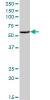 Western Blot: PCOLCE2 Antibody [H00026577-B01P]