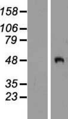 Western Blot: PCOLCE2 Overexpression Lysate [NBP2-10344]