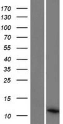 Western Blot: PCOTH Overexpression Lysate [NBP2-09587]